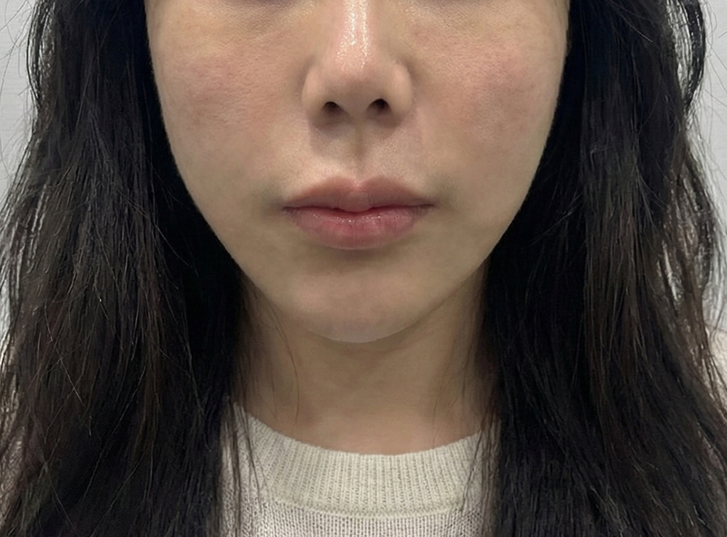 After